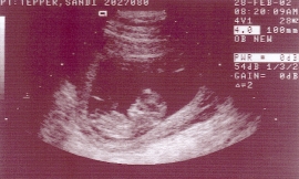 Baby at 11 wk 4 days